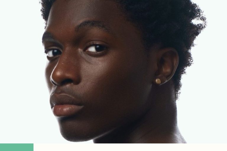 Brûlure après laser sur peau noire : que surveiller sur le visage