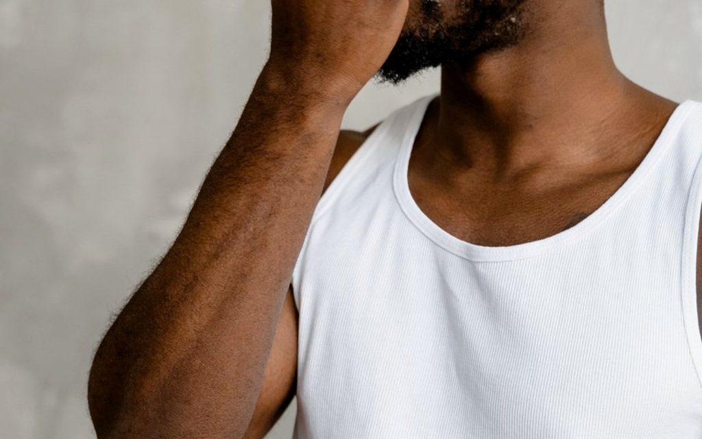 Acné hormonale sur peau noire : menton, mâchoire et marques foncées
